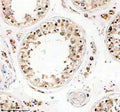 Immunohistochemical staining of TTLL1 using anti-TTLL1 antibody. TTLL1 was detected in a paraffin-embedded section of human testis tissue. Heat mediated antigen retrieval was performed in EDTA buffer (pH 8.0, epitope retrieval solution). The tissue section was blocked with 10% goat serum. The tissue section was then incubated with 2 ug/ml rabbit anti-TTLL1 antibody overnight at 4oC. Peroxidase Conjugated Goat Anti-rabbit IgG was used as secondary antibody and incubated for 30 min at 37oC.