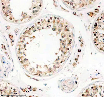 Immunohistochemical staining of TTLL1 using anti-TTLL1 antibody. TTLL1 was detected in a paraffin-embedded section of human testis tissue. Heat mediated antigen retrieval was performed in EDTA buffer (pH 8.0, epitope retrieval solution). The tissue section was blocked with 10% goat serum. The tissue section was then incubated with 2 ug/ml rabbit anti-TTLL1 antibody overnight at 4oC. Peroxidase Conjugated Goat Anti-rabbit IgG was used as secondary antibody and incubated for 30 min at 37oC.