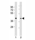 Western blot testing of BMI1 antibody at 1:2000 dilution. Lane 1: SW480 lysate; 2: HeLa lysate; Predicted molecular weight: 37-43 kDa.