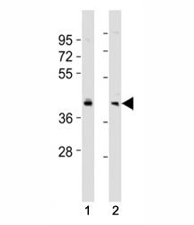 Western blot testing of BMI1 antibody at 1:2000 dilution. Lane 1: SW480 lysate; 2: HeLa lysate; Predicted molecular weight: 37-43 kDa.
