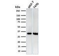Western blot testing of human MCF7 and T47D cell lysate with recombinant RPA32 antibody. Expected molecular weight ~32 kDa.