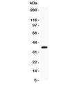 Western blot testing of FSH beta antibody and recombinant human protein (0.5ng)