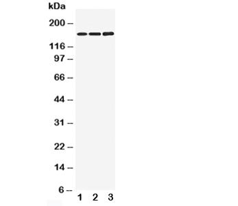 Western blot testing of NMDAR2B antibody and Lane 1: rat brain; 2: mouse brain; 3: human U87 cell lysate. Predicted molecular weight ~166kDa.