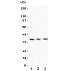 Western blot testing of NKX2.5 antibody and Lane 1: mouse spleen; 2: mouse heart; 3: human HeLa lysate. Predicted molecular weight ~35 kDa, routinely observed at 35~45kDa.