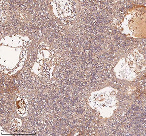 IHC staining of FFPE human spleen tissue with SAMD9L antibody, HRP-secondary and DAB substrate. HIER: boil tissue sections in pH8 EDTA for 20 min and allow to cool before testing.