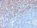 IHC staining of FFPE human tonsil tissue with CD5 antibody (clone rC5/6976). HIER: boil tissue sections in pH 9 10mM Tris with 1mM EDTA for 20 min and allow to cool before testing.