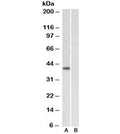 Western blot testing of HeLa nuclear [A] and cytosolic [B] lysates with TBP antibody at 1ug/ml. Predicted molecular weight ~38kDa.