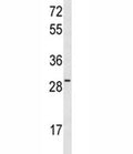 Western blot analysis of HES6 antibody and MCF-7 lysate.