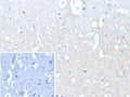IHC staining of FFPE human brain tissue with recombinant NCAM-L1 antibody (clone L1CAM/9146R). Inset: PBS used in place of primary Ab (secondary Ab negative control). HIER: boil tissue sections in pH 9 10mM Tris with 1mM EDTA for 20 min and allow to cool before testing.