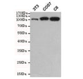 Western blot testing of mouse NIH3T3, monkey COS7 and rat C6 cell lysates using Hexokinase 2 antibody at 1:500. Predicted molecular weight ~102 kDa.