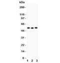Western blot testing of Factor VII antbody and human Lane 1: SMMC-7721; 2: Jurkat; 3: Raji lysate; Predicted molecular weigh ~51 kDa but may be observed at higher molecular weights due to glycosylation.