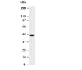 Western blot testing of HSD17B2 antibody and human placenta lysate; Predicted size: 43KD; Observed size: 43KD