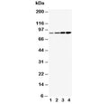 Western blot testing of PI3K antibody and human lysates from 1) MCF-7, 2) HeLa, 3) COLO-320 and 4) SW620 cells. Predicted molecular weight ~85 kDa.