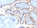 IHC staining of FFPE human placental tissue with HCG-alpha antibody (clone rHCGa/6975). Inset: PBS used in place of primary Ab (secondary Ab negative control). HIER: boil tissue sections in pH 9 10mM Tris with 1mM EDTA for 20 min and allow to cool before testing.