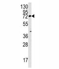 Western blot analysis of Rex1 antibody and mouse lung tissue lysate