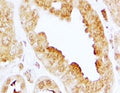 IHC testing of FFPE human kidney with EDG3 antibody at 2ug/ml. HIER: steamed with pH6 citrate buffer, HRP-staining.
