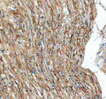 Immunohistochemical staining of TGFBI using anti-TGFBI antibody. TGFBI was detected in a paraffin-embedded section of human intestinal smooth muscle tissue. Heat mediated antigen retrieval was performed in EDTA buffer (pH 8.0, epitope retrieval solution). The tissue section was blocked with 10% goat serum. The tissue section was then incubated with 2 ug/ml rabbit anti-TGFBI antibody overnight at 4oC. Peroxidase Conjugated Goat Anti-rabbit IgG was used as secondary antibody and incubated for 30 min at 37oC.