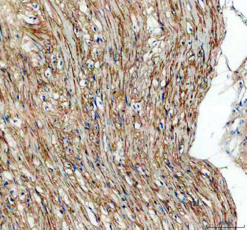 Immunohistochemical staining of TGFBI using anti-TGFBI antibody. TGFBI was detected in a paraffin-embedded section of human intestinal smooth muscle tissue. Heat mediated antigen retrieval was performed in EDTA buffer (pH 8.0, epitope retrieval solution). The tissue section was blocked with 10% goat serum. The tissue section was then incubated with 2 ug/ml rabbit anti-TGFBI antibody overnight at 4oC. Peroxidase Conjugated Goat Anti-rabbit IgG was used as secondary antibody and incubated for 30 min at 37oC.