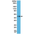 Western blot testing of human Jurkat cell lysate with recombinant CD4 antibody at 1:2500. Expected molecular weight: 50-55 kDa.