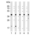 Western blot testing of human 1) K562, 2) HepG2, 3) Jurkat, 4) CCRF-CEM and 5) brain lysate with Cyclophilin D antibody. Predicted molecular weight: ~40 kDa