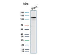Western blot testing of human brain tissue lysate with HK1 antibody (clone HK1/9506). Predicted molecular weight ~120 kDa.