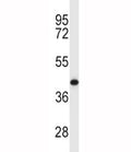 MCL1 antibody western blot analysis in Y79 lysate. Predicted molecular weight: 37/29 kDa (isoforms 1/2).