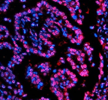 Immunofluorescent staining of NUPR1 using anti-NUPR1 antibody (red). NUPR1 was detected in a paraffin-embedded section of mouse pancreas tissue. Heat mediated antigen retrieval was performed in EDTA buffer (pH 8.0, epitope retrieval solution). The tissue section was blocked with 10% goat serum. The tissue section was then incubated with 5 ug/ml rabbit anti-NUPR1 antibody overnight at 4oC. Cy3 Conjugated Goat Anti-Rabbit IgG was used as secondary antibody at 1:500 dilution and incubated for 30 min at 37oC.