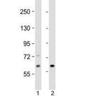 Western blot testing of human 1) Jurkat and 2) human fetal kidney lysate with EPHX2 antibody at 1:2000. Predicted molecular weight: 63/57 kDa (isoforms 1/2).