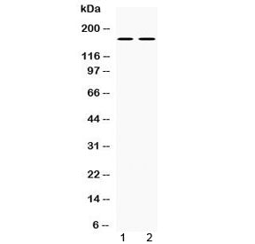 Western blot testing of 1) rat brain and 2) mouse brain lysate with NOS1 antibody at 0.5ug/ml. Predicted molecular weight ~160 kDa.