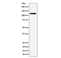 Western blot testing of human HeLa cell lysate with Kinesin 1 heavy chain antibody. Predicted molecular weight ~110 kDa.