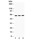 Western blot testing of 1) rat brain, 2) mouse brain and 3) human U-2 0S lysate with TCP1 theta antibody. Expected/observed molecular weight ~60 kDa.