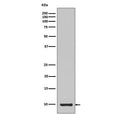 Western blot testing of recombinant partial protein with IGF1 antibody.