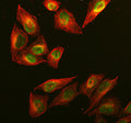 Immunofluorescent staining of RAD51AP1 using anti-RAD51AP1 antibody (green) and anti-Beta Tubulin antibody (red). RAD51AP1 was detected in immunocytochemical section of U2OS cell. Enzyme antigen retrieval was performed using IHC enzyme antigen retrieval reagent for 15 mins. The cells were blocked with 10% goat serum. And then incubated with 5 ug/ml rabbit anti-RAD51AP1 antibody and mouse anti-Beta Tubulin antibody overnight at 4oC.