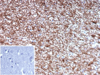 IHC staining of FFPE human brain tissue with GFAP antibody (clone GFAP/9422). Inset: PBS used in place of primary Ab (secondary Ab negative control). HIER: boil tissue sections in pH 9 10mM Tris with 1mM EDTA for 20 min and allow to cool before testing.
