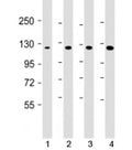 Western blot testing of 1) human DU-145, 2) human HepG2, 3) mouse brain and 4) HeLa cell lysate with AIP1 antibody at 1:1000. Predicted molecular weight: 132 kDa.
