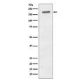 Western blot testing of lysate from human A431 cells treated with EGF with phospho-EGFR antibody. Expected molecular weight: 134-170 kDa depending on glycosylation level.
