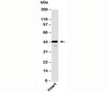 Western blot testing of human samples with Als2Cr2 antibody at 6ug/ml.