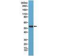 Western blot testing of human HeLa lysate with recombinant Vimentin antibody at 1:400 dilution. Predicted molecular weight ~53 kDa.