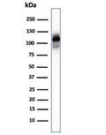 Western blot testing of human skeletal muscle lysate with Sarcomeric Alpha Actinin antibody (clone ACTN2/3293). Predicted molecular weigth ~103 kDa.