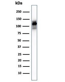 Western blot testing of human skeletal muscle lysate with Sarcomeric Alpha Actinin antibody (clone ACTN2/3293). Predicted molecular weigth ~103 kDa.
