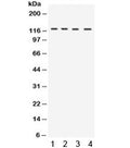 Western blot testing of 1) rat liver, 2) mouse liver, 3) mouse testis and 4) human HeLa lysate with UBA1 antibody. Expected molecular weight: ~118/114 kDa (isoforms a/b).