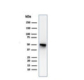 Western blot testing of human spleen lysate with Thymidine Phosphorylase antibody (clone P-GF.44C). Predicted molecular weight ~55 kDa.