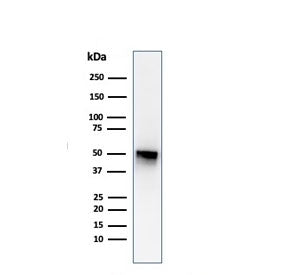 Western blot testing of human spleen lysate with Thymidine Phosphorylase antibody (clone P-GF.44C). Predicted molecular weight ~55 kDa.