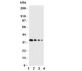Western blot testing of GCN2 antbody; Lane 1: Recombinant mouse protein 10ng; 2: 5ng; 3: 2.5ng; 4: 1.25ng