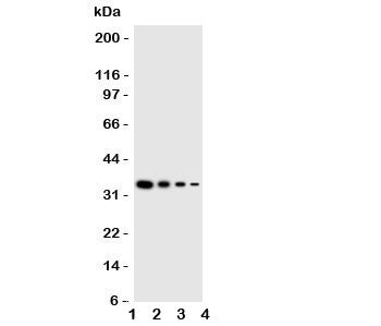 Western blot testing of GCN2 antbody; Lane 1: Recombinant mouse protein 10ng; 2: 5ng; 3: 2.5ng; 4: 1.25ng