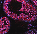 Immunofluorescent staining of TAOK2 using anti-TAOK2 antibody (red). TAOK2 was detected in a paraffin-embedded section of human testis tissue. Heat mediated antigen retrieval was performed in EDTA buffer (pH 8.0, epitope retrieval solution). The tissue section was blocked with 10% goat serum. The tissue section was then incubated with 5 ug/ml rabbit anti-TAOK2 antibody overnight at 4oC. Cy3 Conjugated Goat Anti-Rabbit IgG was used as secondary antibody at 1:500 dilution and incubated for 30 min at 37oC.