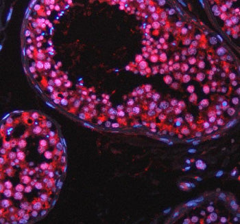 Immunofluorescent staining of TAOK2 using anti-TAOK2 antibody (red). TAOK2 was detected in a paraffin-embedded section of human testis tissue. Heat mediated antigen retrieval was performed in EDTA buffer (pH 8.0, epitope retrieval solution). The tissue section was blocked with 10% goat serum. The tissue section was then incubated with 5 ug/ml rabbit anti-TAOK2 antibody overnight at 4oC. Cy3 Conjugated Goat Anti-Rabbit IgG was used as secondary antibody at 1:500 dilution and incubated for 30 min at 37oC.