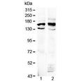 Western blot testing of 1) rat brain and 2) mouse brain lysate with Formin antibody at 0.5ug/ml. Predicted molecular weight: ~158 kDa (isoform 1) and ~132 kDa (isoform 5).