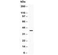 Western blot testing of recombinant human protein with IGFBP3 antibody at 0.5ug/ml. Expected molecular weight: ~31/40-44 kDa (unmodified/glycosylated).