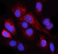 Immunofluorescent staining of NUP98 using anti-NUP98 antibody (red). NUP98 was detected in an immunocytochemical section of cells. Enzyme antigen retrieval was performed using IHC enzyme antigen retrieval reagent for 15 mins. The cells were blocked with 10% goat serum. And then incubated with 5 ug/ml rabbit anti-NUP98 antibody overnight at 4oC. Cy3 Conjugated Goat Anti-Rabbit IgG was used as secondary antibody at 1:500 dilution and incubated for 30 min at 37oC.